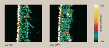 Therapieerfolg am Ultraschallbild